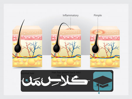 اموزش نکات ترکیبی زیست شناسی | نکات ترکیبی غدد برون ریز |تمام نکات غدد برون ریز کنکوری 